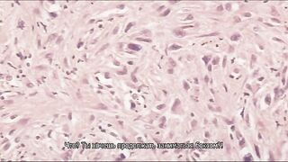 The Urotsuki ep1 RUS SUB