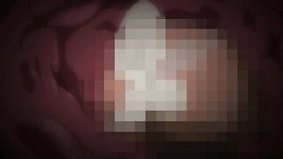 Sleepless: A Midsummer Night's Dream ep1